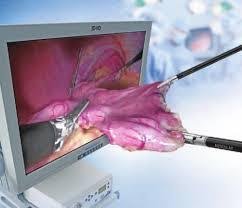 302bccb2-6008-4dd1-bd36-6d3b6705aa2d